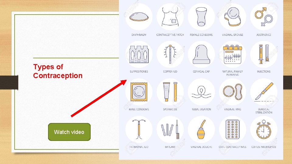 Types of Contraception Watch video 