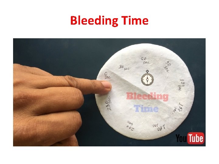 Bleeding Time 