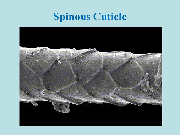 Spinous Cuticle 