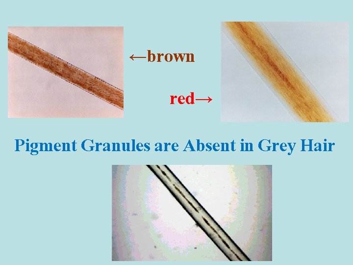 ←brown red→ Pigment Granules are Absent in Grey Hair 