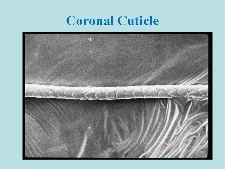 Coronal Cuticle 