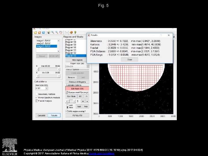 Evaluation of a breast software model for 2