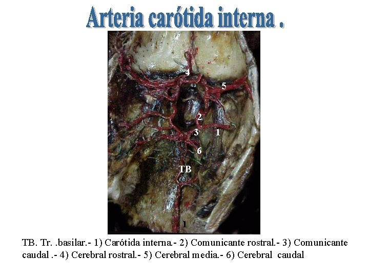 4 5 2 3 1 6 TB 1 TB. Tr. . basilar. - 1)