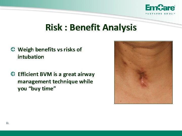 Risk : Benefit Analysis Weigh benefits vs risks of intubation Efficient BVM is a