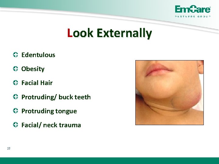 Look Externally Edentulous Obesity Facial Hair Protruding/ buck teeth Protruding tongue Facial/ neck trauma