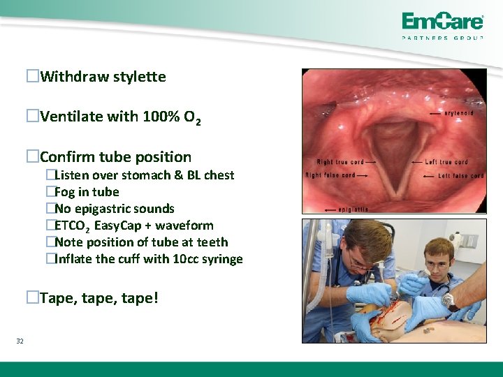 �Withdraw stylette �Ventilate with 100% O 2 �Confirm tube position �Listen over stomach &