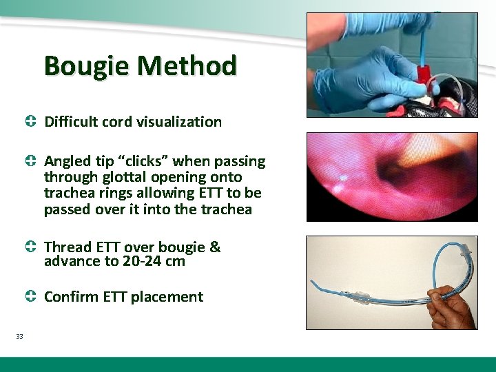 Bougie Method Difficult cord visualization Angled tip “clicks” when passing through glottal opening onto