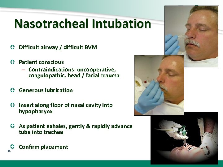 Nasotracheal Intubation Difficult airway / difficult BVM Patient conscious – Contraindications: uncooperative, coagulopathic, head