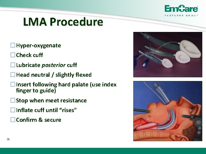 LMA Procedure �Hyper-oxygenate �Check cuff �Lubricate posterior cuff �Head neutral / slightly flexed �Insert