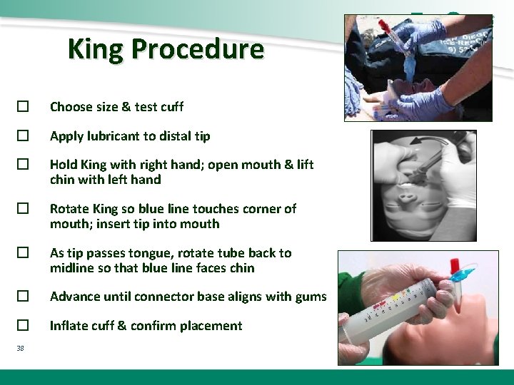 King Procedure � Choose size & test cuff � Apply lubricant to distal tip