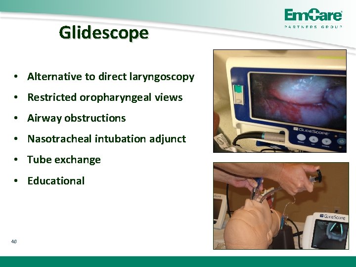 Glidescope • Alternative to direct laryngoscopy • Restricted oropharyngeal views • Airway obstructions •