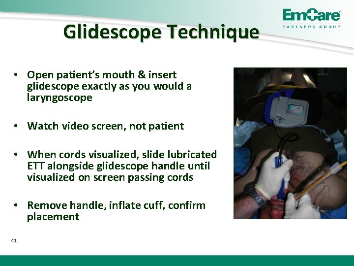 Glidescope Technique • Open patient’s mouth & insert glidescope exactly as you would a