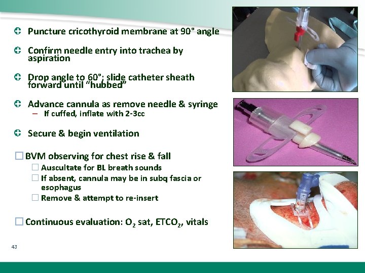 Puncture cricothyroid membrane at 90° angle Confirm needle entry into trachea by aspiration Drop