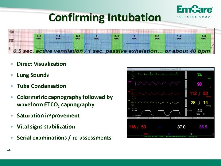 Confirming Intubation • Direct Visualization • Lung Sounds • Tube Condensation • Colormetric capnography