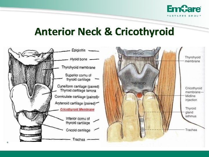 Anterior Neck & Cricothyroid 6 