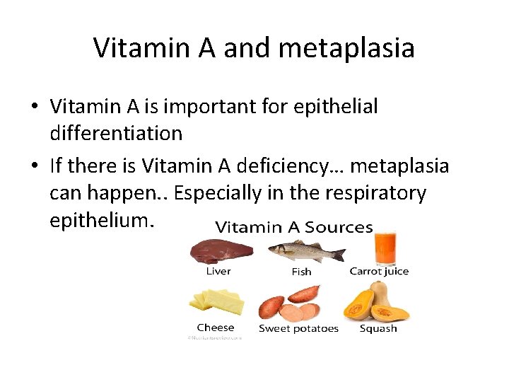 Vitamin A and metaplasia • Vitamin A is important for epithelial differentiation • If