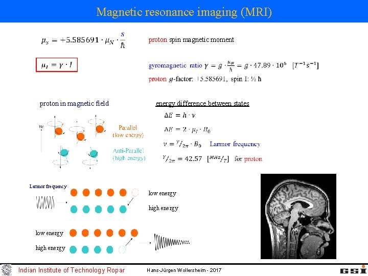 Magnetic resonance imaging (MRI) proton spin magnetic moment proton in magnetic field energy difference