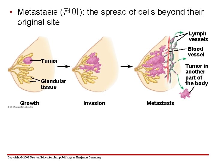  • Metastasis (전이): the spread of cells beyond their original site Lymph vessels