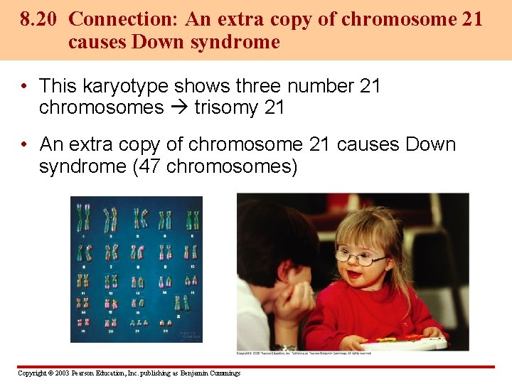 8. 20 Connection: An extra copy of chromosome 21 causes Down syndrome • This
