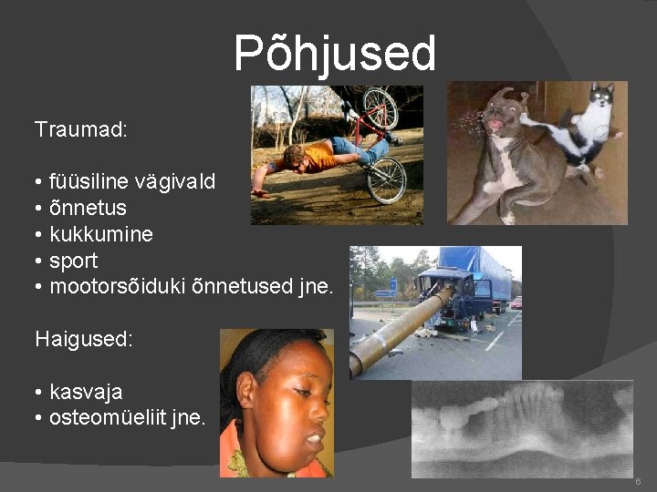 Põhjused Traumad: • füüsiline vägivald • õnnetus • kukkumine • sport • mootorsõiduki õnnetused
