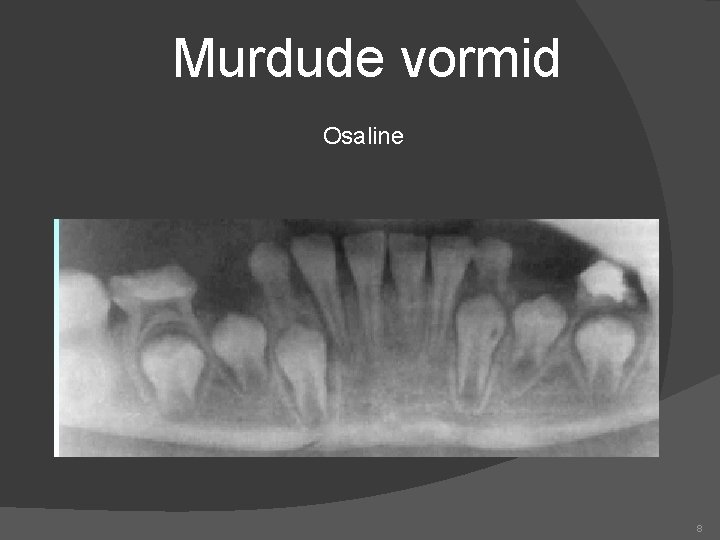 Murdude vormid Osaline 8 