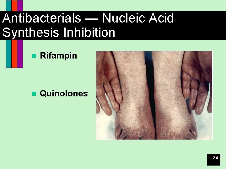 Antibacterials — Nucleic Acid Synthesis Inhibition n Rifampin n Quinolones 34 