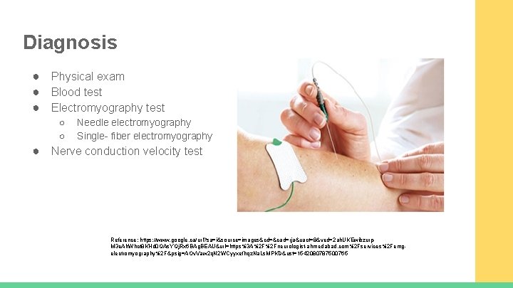 Diagnosis ● Physical exam ● Blood test ● Electromyography test ○ ○ Needle electromyography