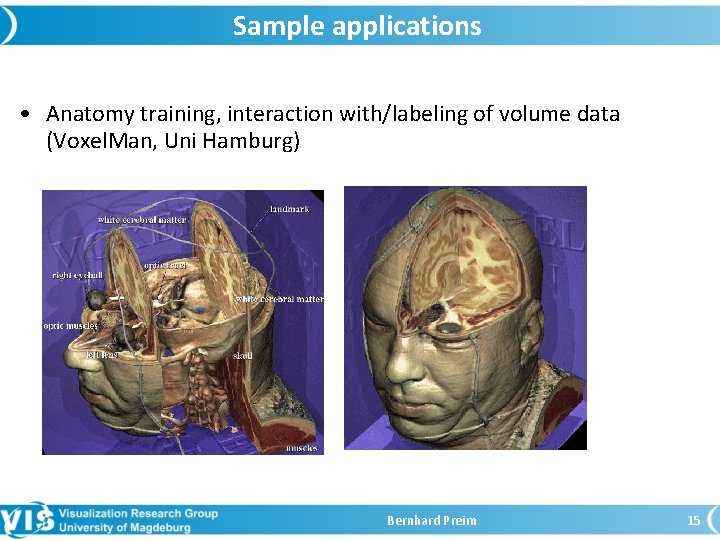 Sample applications • Anatomy training, interaction with/labeling of volume data (Voxel. Man, Uni Hamburg)