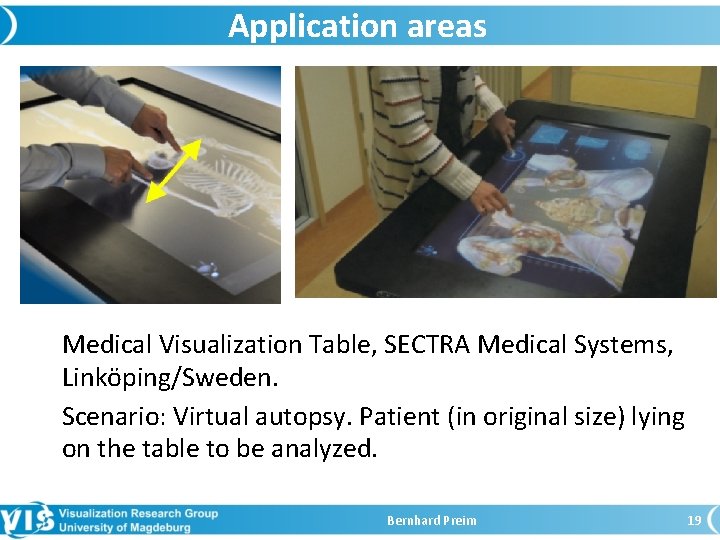 Application areas Medical Visualization Table, SECTRA Medical Systems, Linköping/Sweden. Scenario: Virtual autopsy. Patient (in