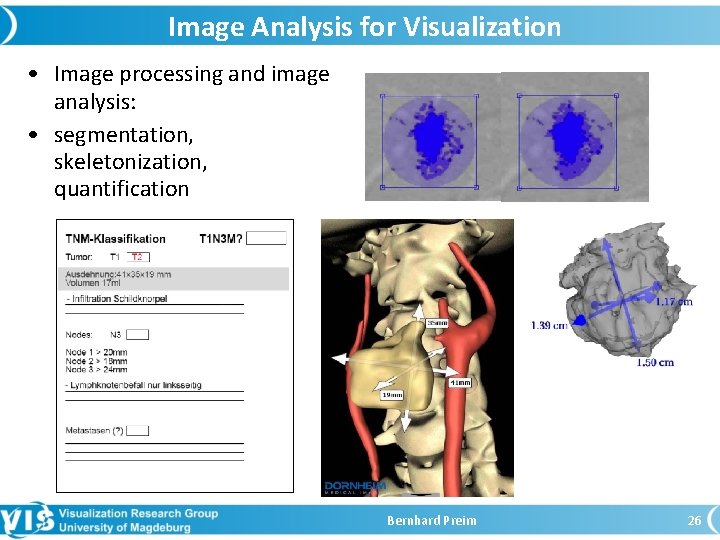 Image Analysis for Visualization • Image processing and image analysis: • segmentation, skeletonization, quantification