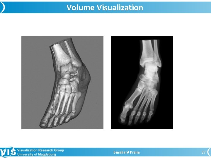 Volume Visualization Bernhard Preim 27 