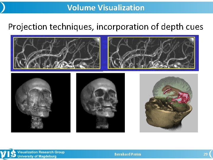 Volume Visualization Projection techniques, incorporation of depth cues Bernhard Preim 29 