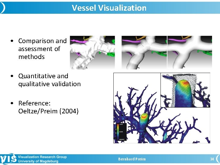 Vessel Visualization • Comparison and assessment of methods • Quantitative and qualitative validation •