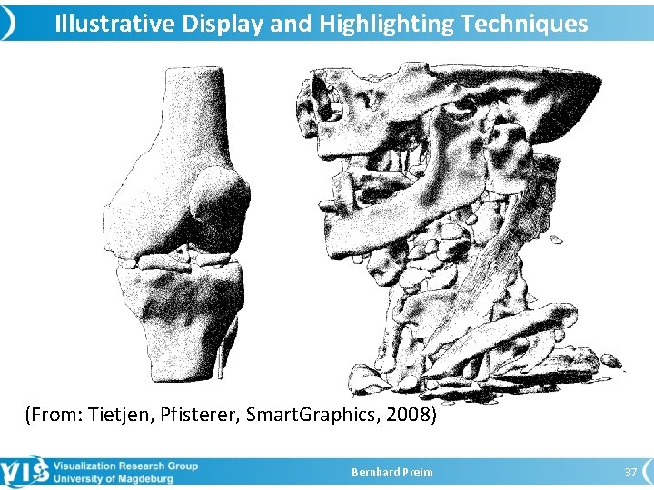 Illustrative Display and Highlighting Techniques (From: Tietjen, Pfisterer, Smart. Graphics, 2008) Bernhard Preim 37