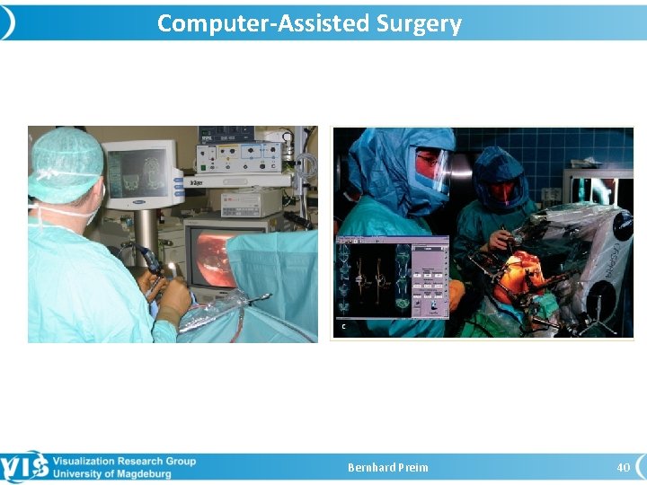 Computer-Assisted Surgery Bernhard Preim 40 