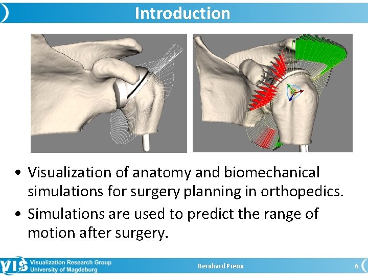 Introduction • Visualization of anatomy and biomechanical simulations for surgery planning in orthopedics. •