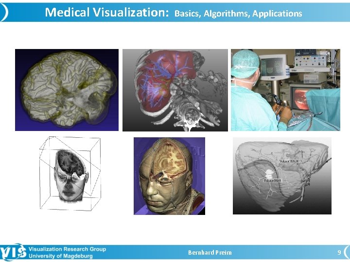 Medical Visualization: Basics, Algorithms, Applications Bernhard Preim 9 