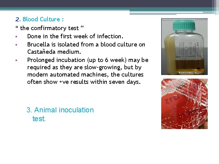 2. Blood Culture : “ the confirmatory test ” • Done in the first