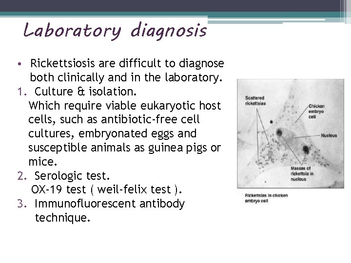 Laboratory diagnosis • Rickettsiosis are difficult to diagnose both clinically and in the laboratory.