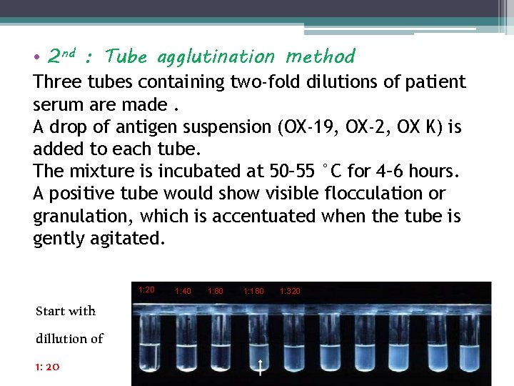 • 2 nd : Tube agglutination method Three tubes containing two-fold dilutions of