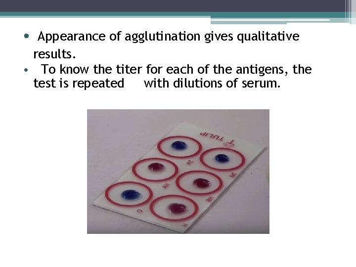  • Appearance of agglutination gives qualitative results. • To know the titer for