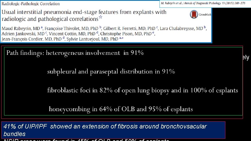 22 patients (20 men, 2 women) transplanted for pulmonary fibrosis were retrospectively CT available