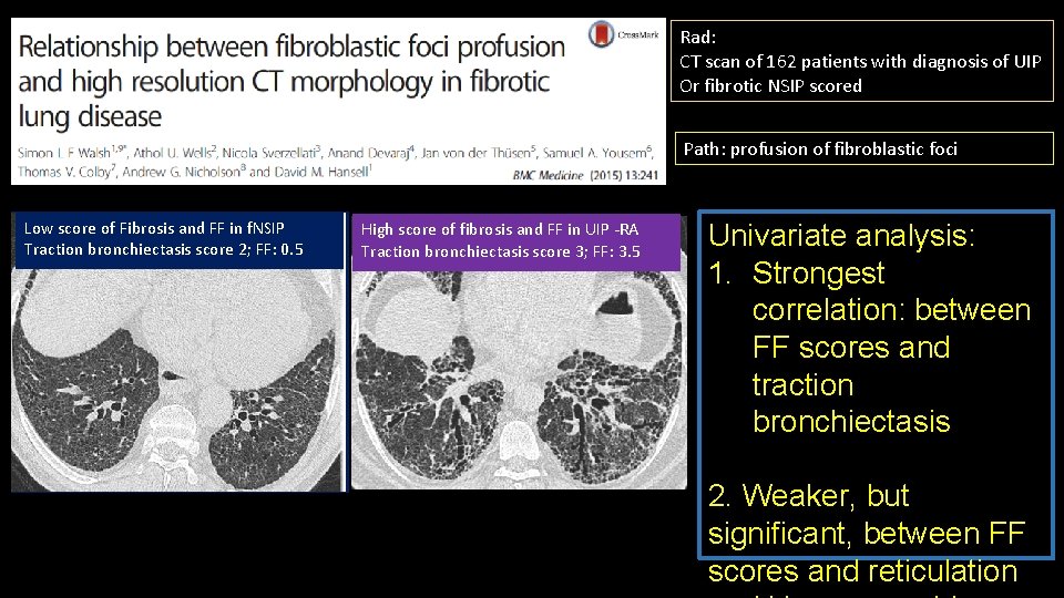 Rad: CT scan of 162 patients with diagnosis of UIP Or fibrotic NSIP scored