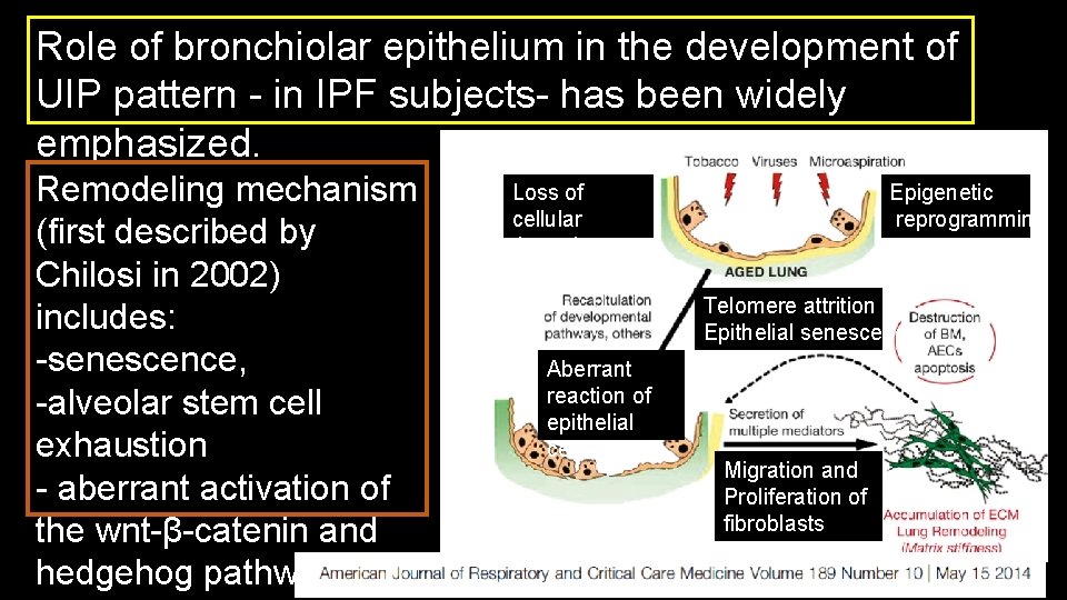 Role of bronchiolar epithelium in the development of UIP pattern - in IPF subjects-