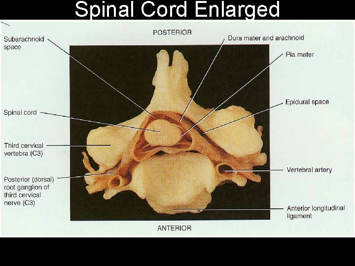 Spinal Cord Enlarged 
