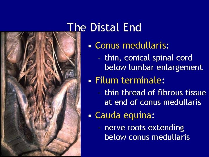 The Distal End • Conus medullaris: – thin, conical spinal cord below lumbar enlargement