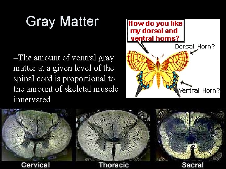 Gray Matter –The amount of ventral gray matter at a given level of the