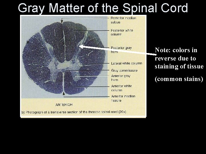 Gray Matter of the Spinal Cord Note: colors in reverse due to staining of