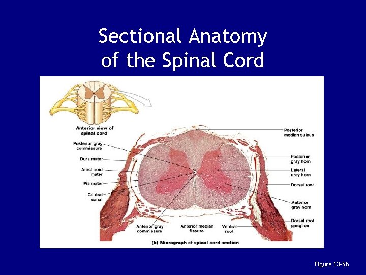 Sectional Anatomy of the Spinal Cord Figure 13– 5 b 