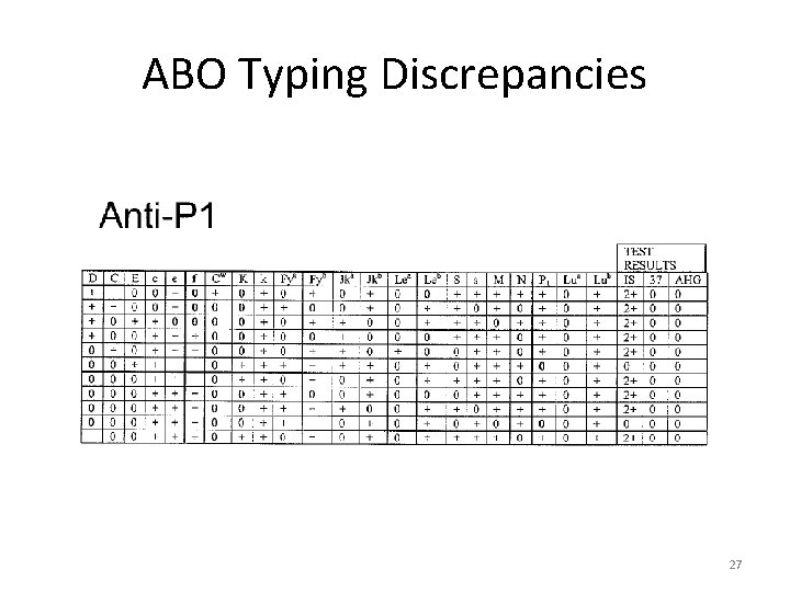 ABO Typing Discrepancies 27 